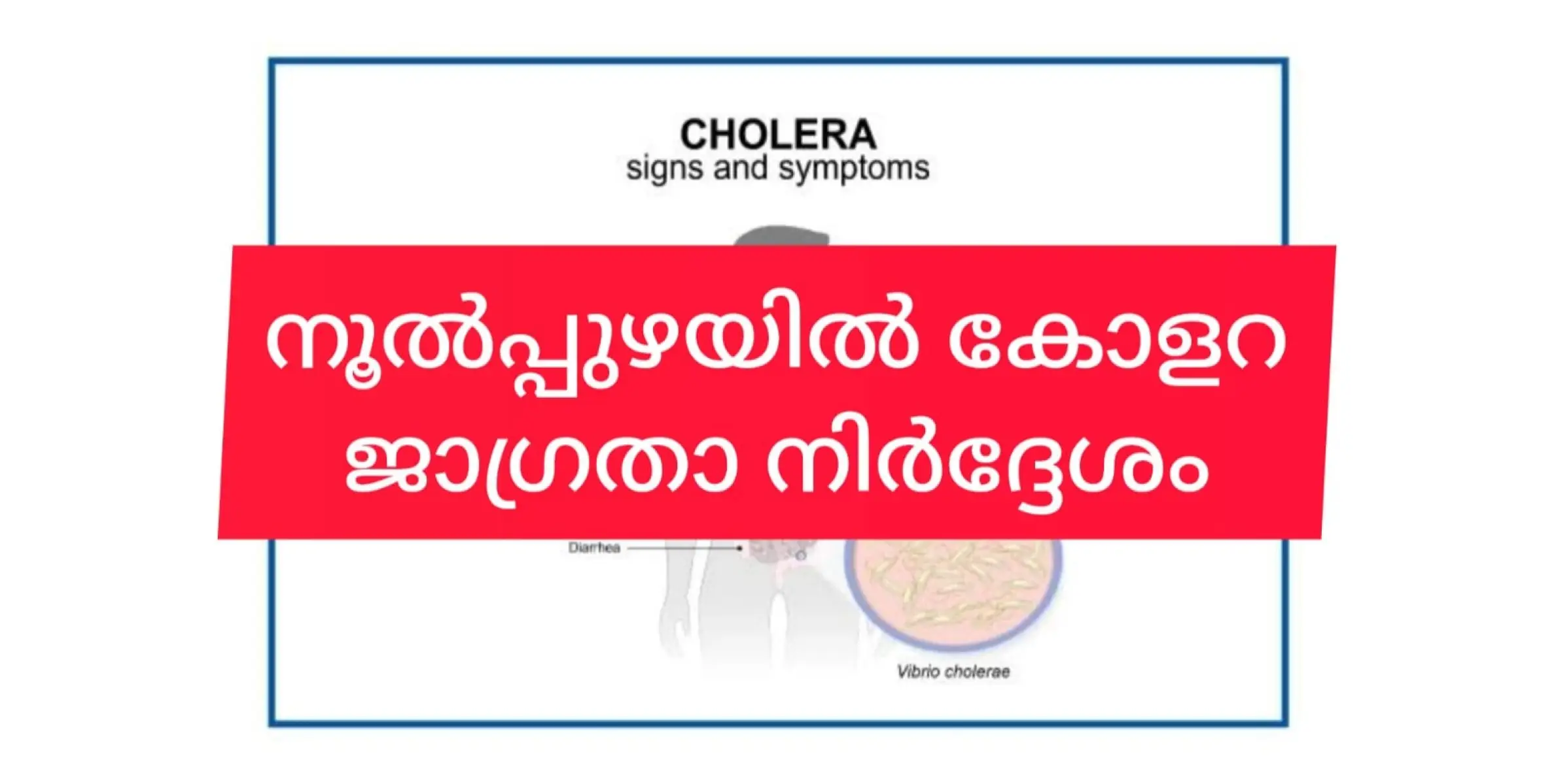 നൂൽപ്പുഴയിൽ കോളറ: ഒരാൾ മരിച്ചു. 10 പേർ ചികിത്സയിൽ.  കണ്ടെയിൻമെന്റ് സോണായി പ്രഖ്യാപിച്ചു.