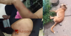  കോഴിക്കോട് നാദാപുരത്ത് തെരുവുനായ ആക്രമണം; യുവതി ഉൾപ്പടെ ആറ് പേർക്ക് കടിയേറ്റു, നായയെ തല്ലിക്കൊന്നു 