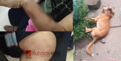  കോഴിക്കോട് നാദാപുരത്ത് തെരുവുനായ ആക്രമണം; യുവതി ഉൾപ്പടെ ആറ് പേർക്ക് കടിയേറ്റു, നായയെ തല്ലിക്കൊന്നു 