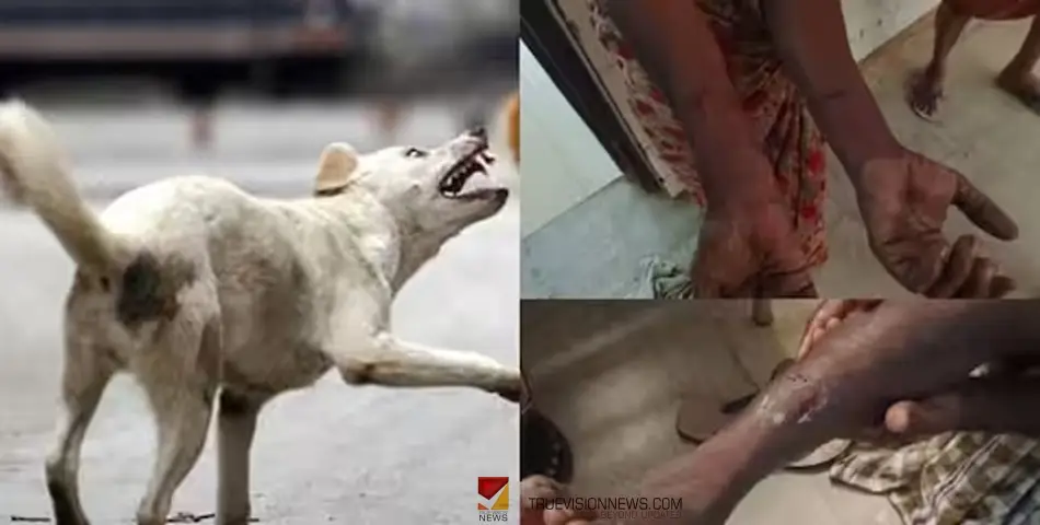 #straydog | തെരുവുനായ ആക്രമണം; വടകരയിൽ നടന്നുപോകുന്നതിനിടെ യാത്രികരെ നായ കടിച്ചു, നാലുപേർക്ക് പരിക്ക് 